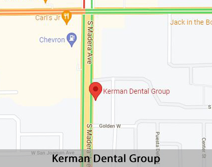 Map image for Why Are My Gums Bleeding in Kerman, CA