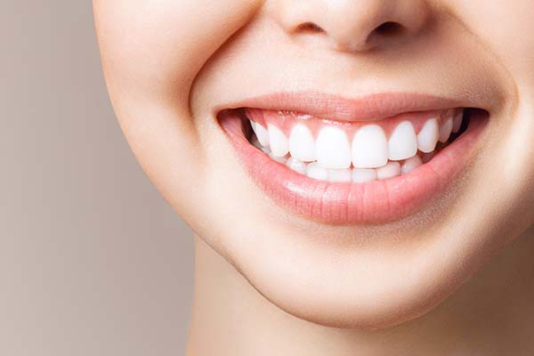 Benefits Of Teeth Whitening